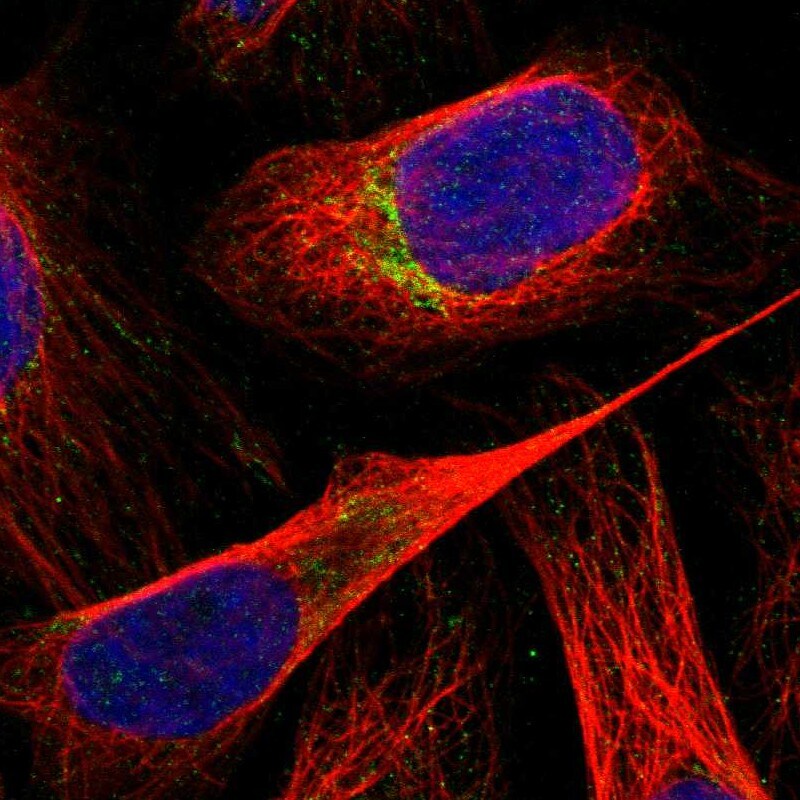 RNMTL1 Antibody - BSA Free Immunocytochemistry/ Immunofluorescence: RNMTL1 Antibody [NBP1-83845]