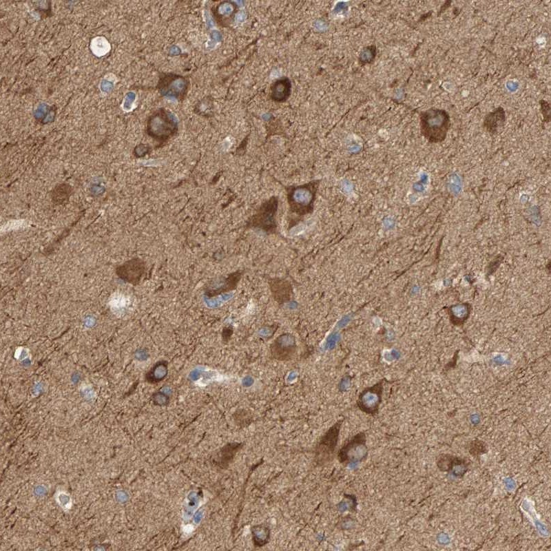 KLHL11 Antibody - BSA Free Immunohistochemistry: KLHL11 Antibody [NBP1-83846]