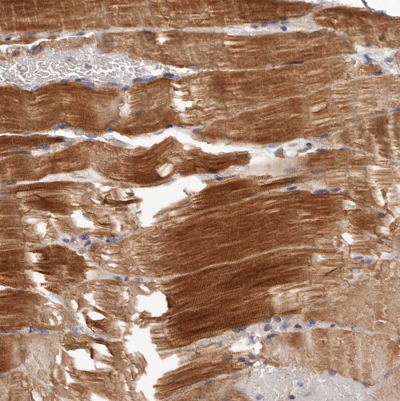 MRPS10 Antibody - BSA Free Immunohistochemistry-Paraffin: MRPS10 Antibody [NBP1-83847]