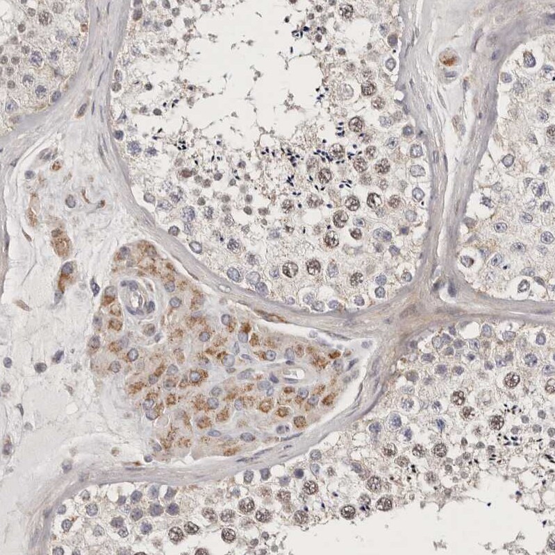 MRPS10 Antibody - BSA Free Immunohistochemistry-Paraffin: MRPS10 Antibody [NBP1-83847]