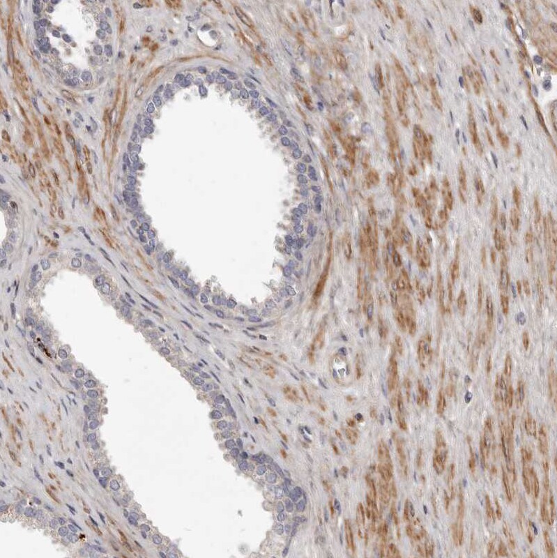 MRPS10 Antibody - BSA Free Immunohistochemistry-Paraffin: MRPS10 Antibody [NBP1-83847]