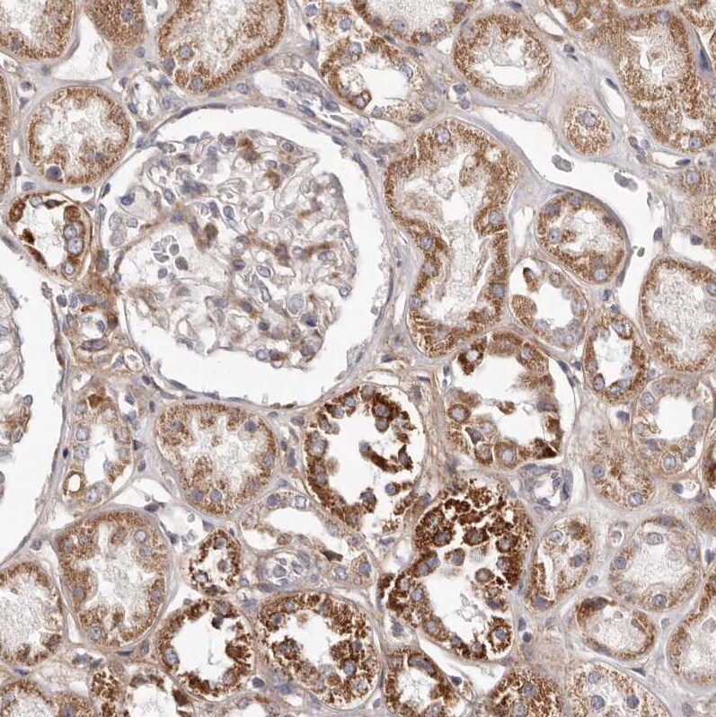 MRPS10 Antibody - BSA Free Immunohistochemistry-Paraffin: MRPS10 Antibody [NBP1-83847]