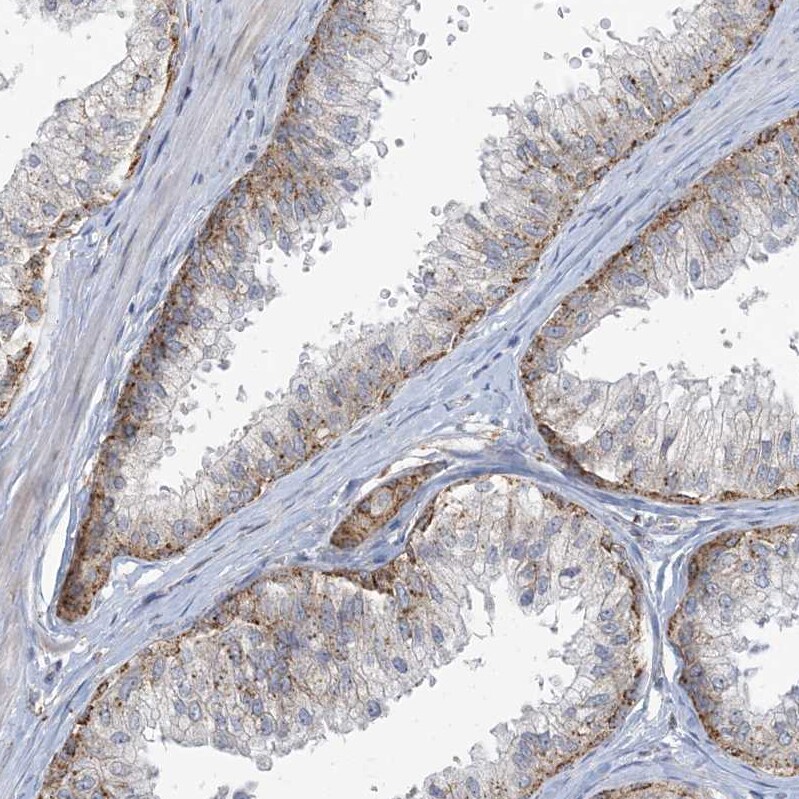 MRPS18A Antibody - BSA Free Immunohistochemistry-Paraffin: MRPS18A Antibody - BSA Free [NBP1-83850]
