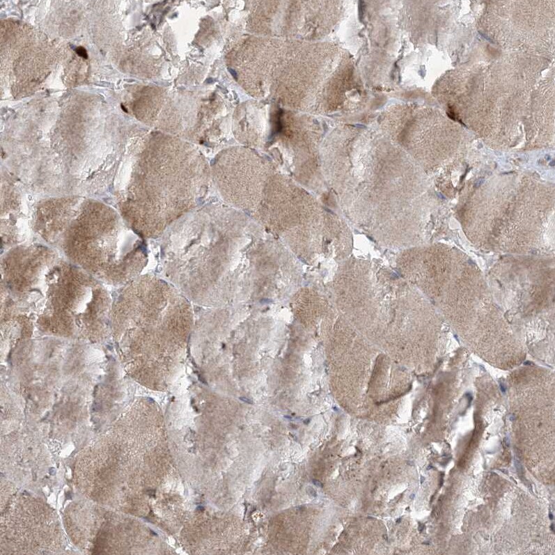 MRPS18A Antibody - BSA Free Immunohistochemistry-Paraffin: MRPS18A Antibody - BSA Free [NBP1-83850]