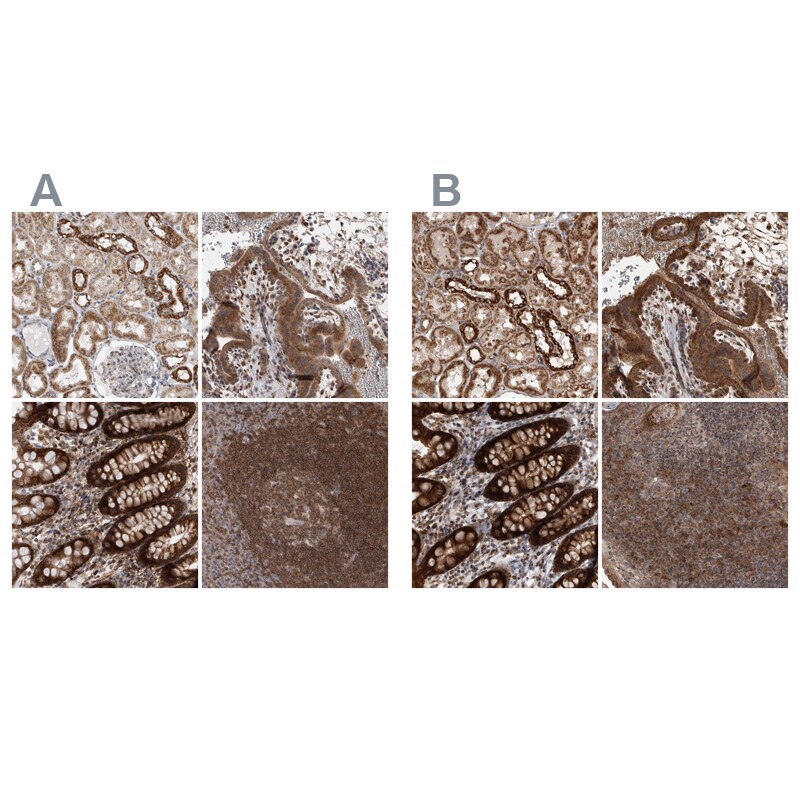 DARS2 Antibody - BSA Free Immunohistochemistry-Paraffin: DARS2 Antibody - BSA Free [NBP1-83854]