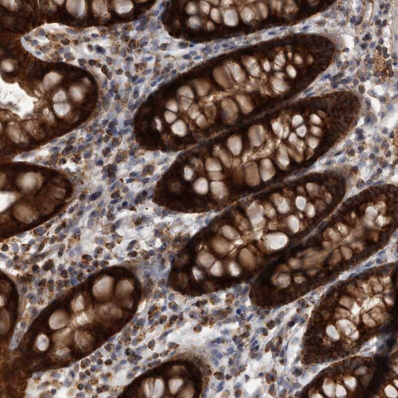 DARS2 Antibody - BSA Free Immunohistochemistry-Paraffin: DARS2 Antibody - BSA Free [NBP1-83855]