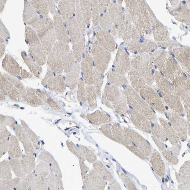 NLE1 Antibody - BSA Free Immunohistochemistry-Paraffin: NLE1 Antibody [NBP1-83860]
