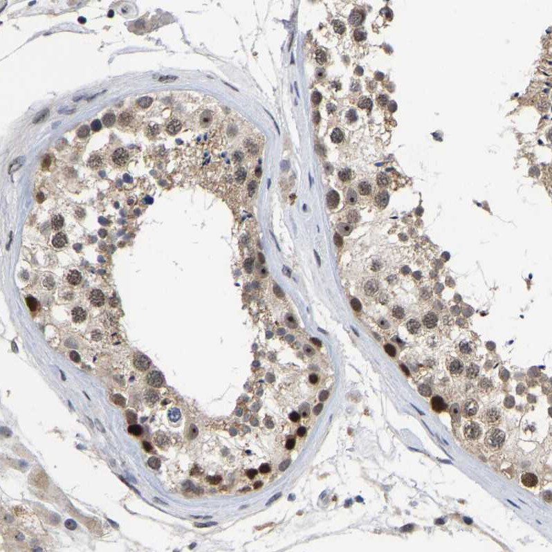 NLE1 Antibody - BSA Free Immunohistochemistry-Paraffin: NLE1 Antibody [NBP1-83860]
