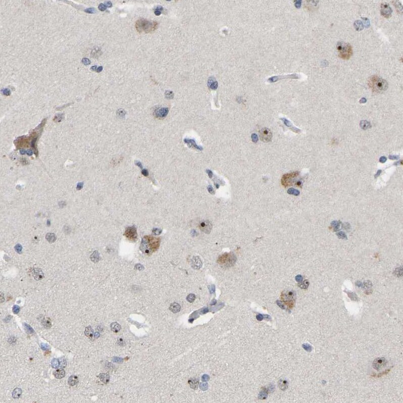 NLE1 Antibody - BSA Free Immunohistochemistry-Paraffin: NLE1 Antibody [NBP1-83860]