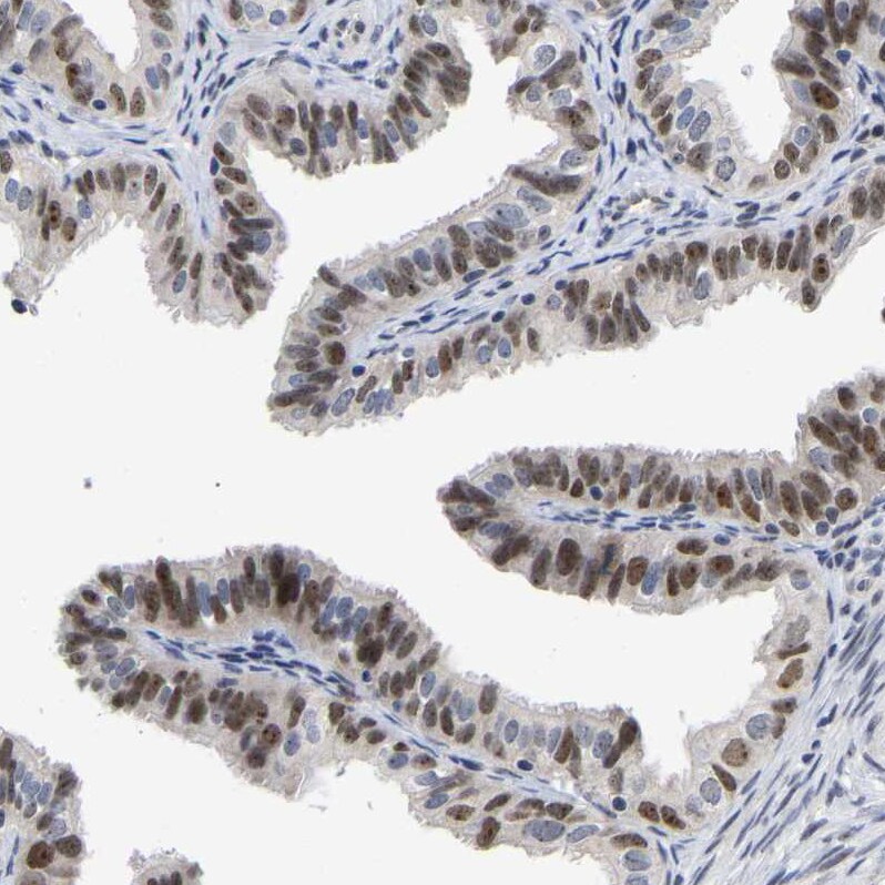 NLE1 Antibody - BSA Free Immunohistochemistry-Paraffin: NLE1 Antibody [NBP1-83860]