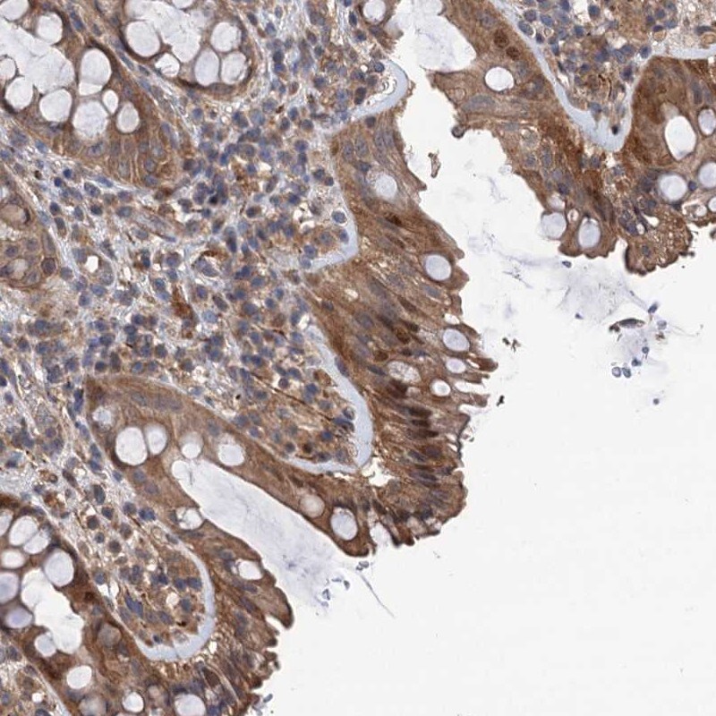 TMEM39B Antibody - BSA Free Immunohistochemistry-Paraffin: TMEM39B Antibody [NBP1-83869]