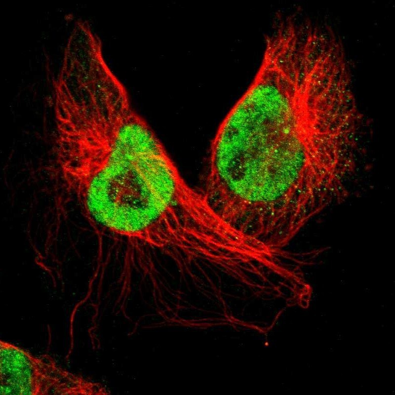 SMEK2 Antibody - BSA Free Immunocytochemistry/ Immunofluorescence: SMEK2 Antibody [NBP1-83882]