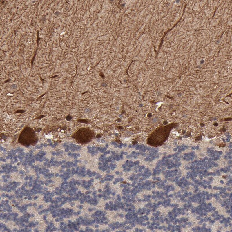 FRMD8 Antibody - BSA Free Immunohistochemistry-Paraffin: FRMD8 Antibody - BSA Free [NBP1-83884]