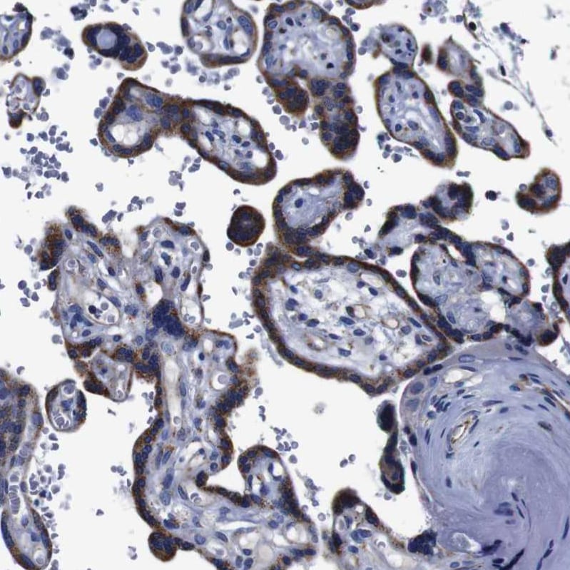 FKBP9 Antibody - BSA Free Immunohistochemistry-Paraffin: FKBP9 Antibody [NBP1-83887]