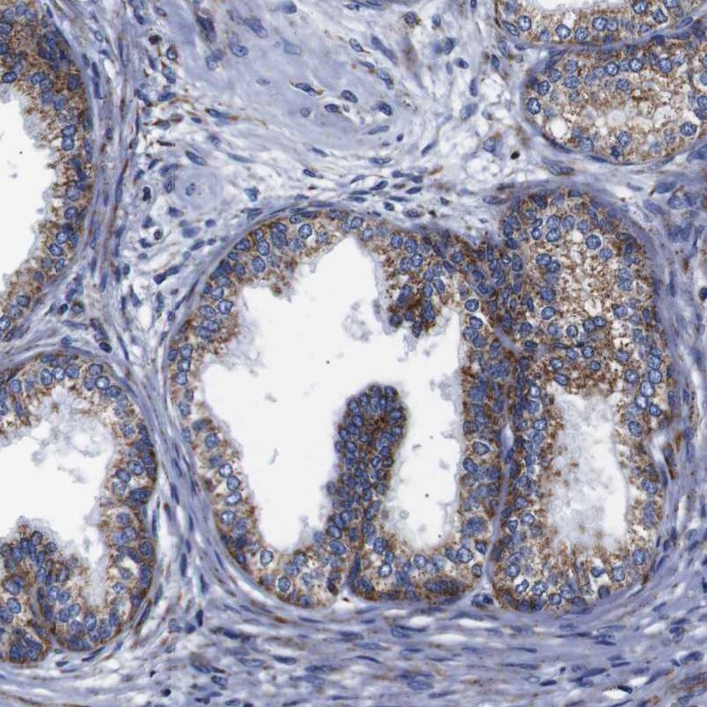 FKBP9 Antibody - BSA Free Immunohistochemistry-Paraffin: FKBP9 Antibody [NBP1-83887]