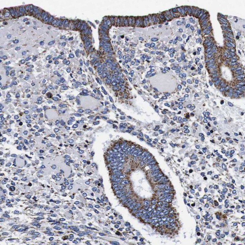 FKBP9 Antibody - BSA Free Immunohistochemistry-Paraffin: FKBP9 Antibody [NBP1-83887]