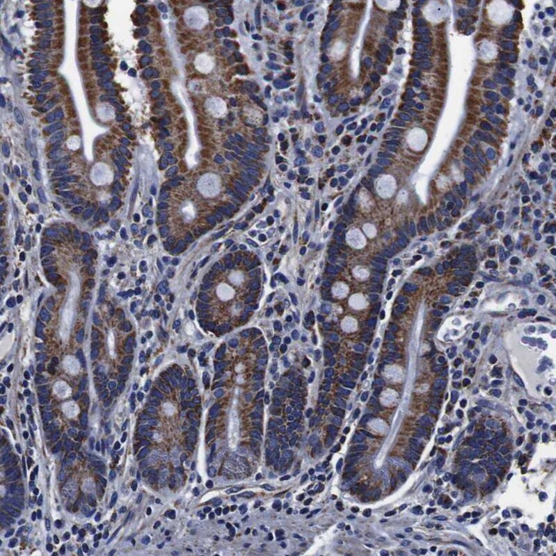 FKBP9 Antibody - BSA Free Immunohistochemistry-Paraffin: FKBP9 Antibody [NBP1-83887]