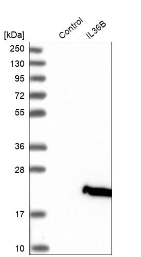 IL-36 beta/IL-1F8 Antibody - BSA Free Western Blot: IL-36 beta/IL-1F8 Antibody - BSA Free [NBP1-83892]
