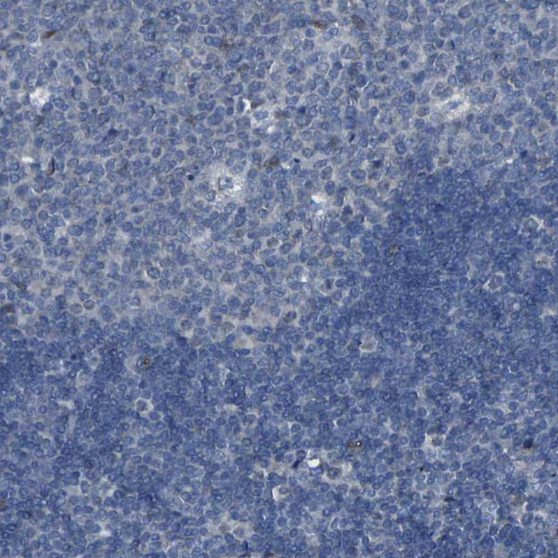 LRRN1/NLRR-1 Antibody - BSA Free Immunohistochemistry-Paraffin: LRRN1/NLRR-1 Antibody - BSA Free [NBP1-83896]