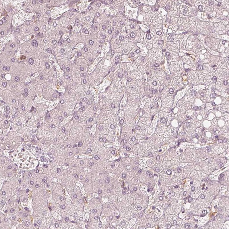 FMNL2 Antibody - BSA Free Immunohistochemistry-Paraffin: FMNL2 Antibody - BSA Free [NBP1-83901]