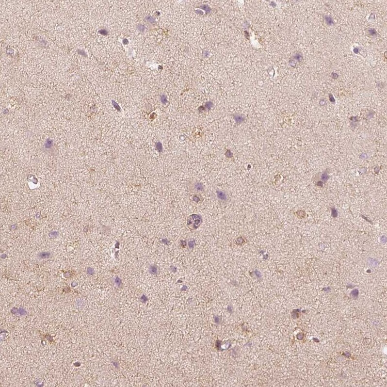 FMNL2 Antibody - BSA Free Immunohistochemistry-Paraffin: FMNL2 Antibody - BSA Free [NBP1-83901]