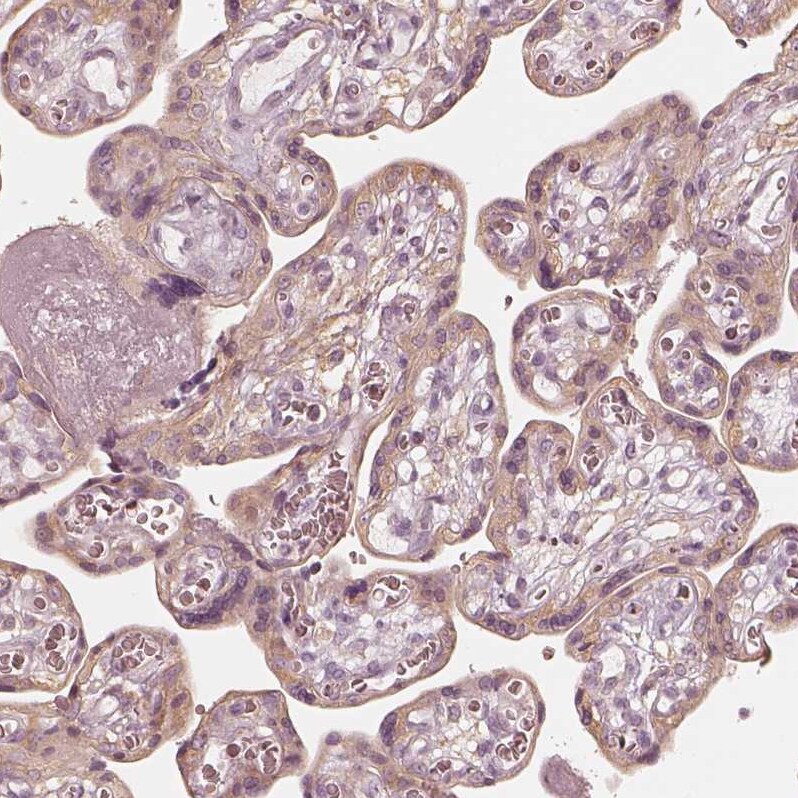 FMNL2 Antibody - BSA Free Immunohistochemistry-Paraffin: FMNL2 Antibody - BSA Free [NBP1-83901]