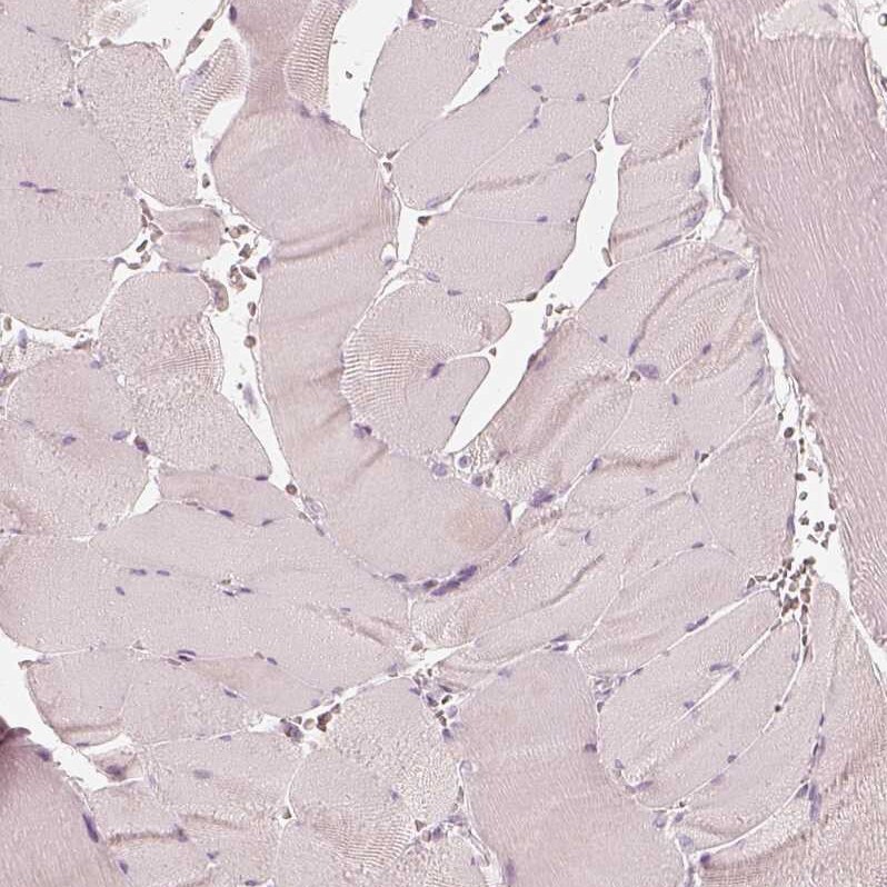 FMNL2 Antibody - BSA Free Immunohistochemistry-Paraffin: FMNL2 Antibody - BSA Free [NBP1-83901]