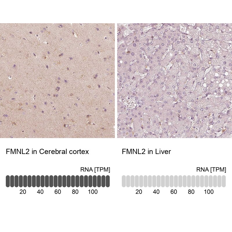 FMNL2 Antibody - BSA Free Immunohistochemistry-Paraffin: FMNL2 Antibody - BSA Free [NBP1-83901]