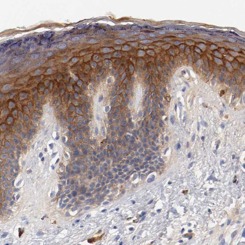 FGF-BP Antibody - BSA Free Immunohistochemistry-Paraffin: FGF-BP Antibody - BSA Free [NBP1-83904]