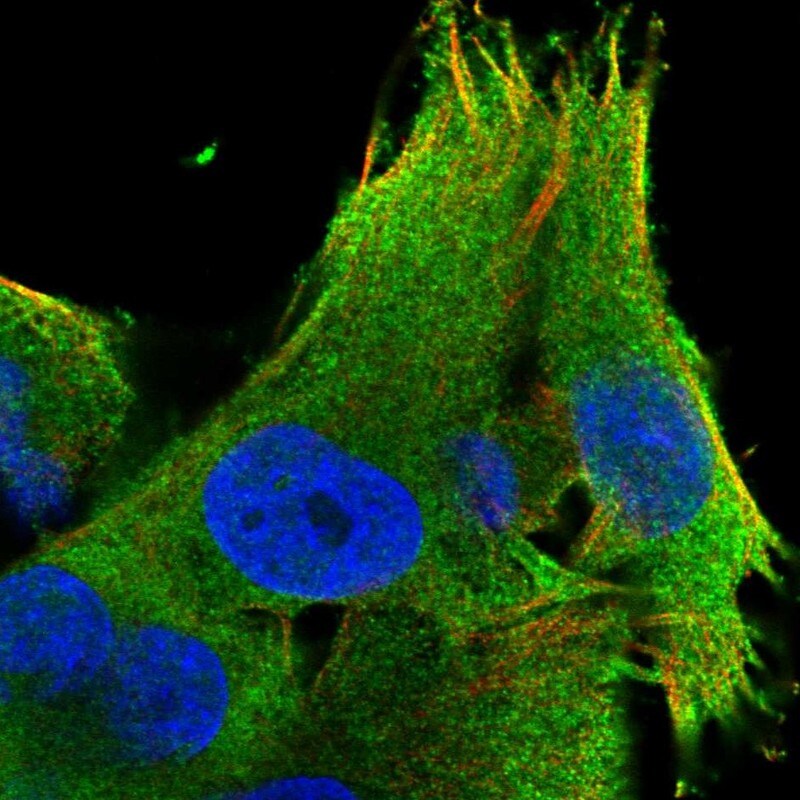 LZTS1 Antibody - BSA Free Immunocytochemistry/ Immunofluorescence: LZTS1 Antibody [NBP1-83908]