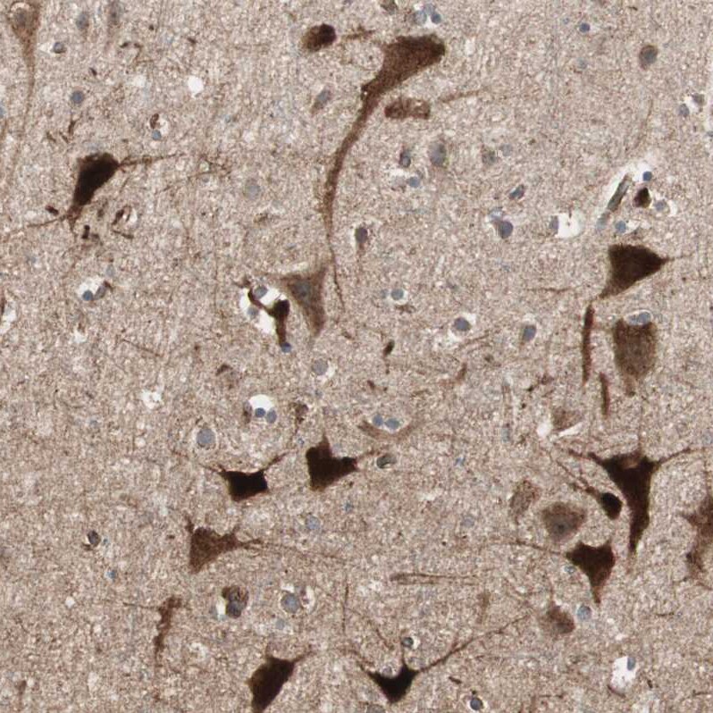 LZTS1 Antibody - BSA Free Immunohistochemistry-Paraffin: LZTS1 Antibody - BSA Free [NBP1-83908]