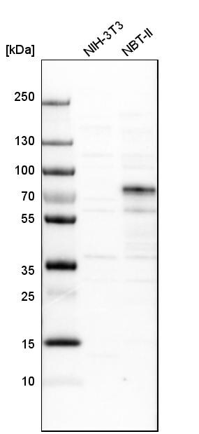 p63/TP73L Antibody Western Blot: SCL/Tal1 Antibody [NBP1-84895]
