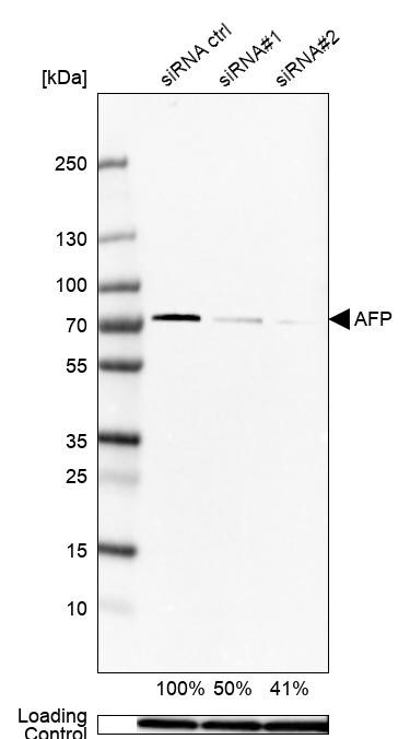 TRIM26 Antibody Western Blot: BTN1A1/Butyrophilin Antibody [NBP1-83910]