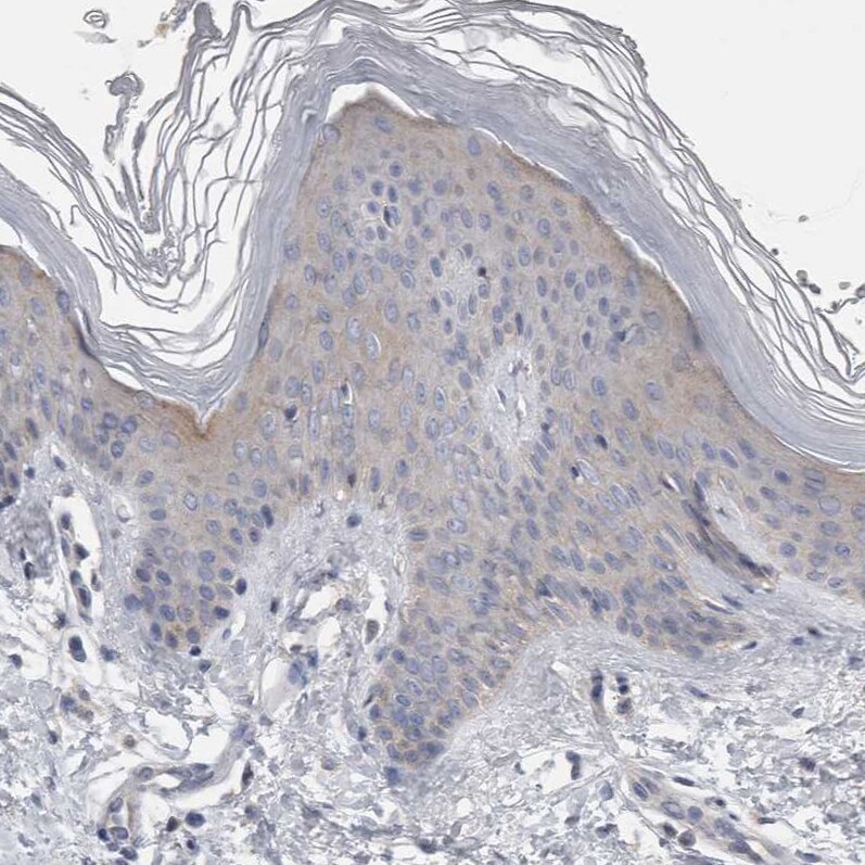 Otoraplin/OTOR Antibody - BSA Free Immunohistochemistry-Paraffin: Otoraplin/OTOR Antibody - BSA Free [NBP1-83912]