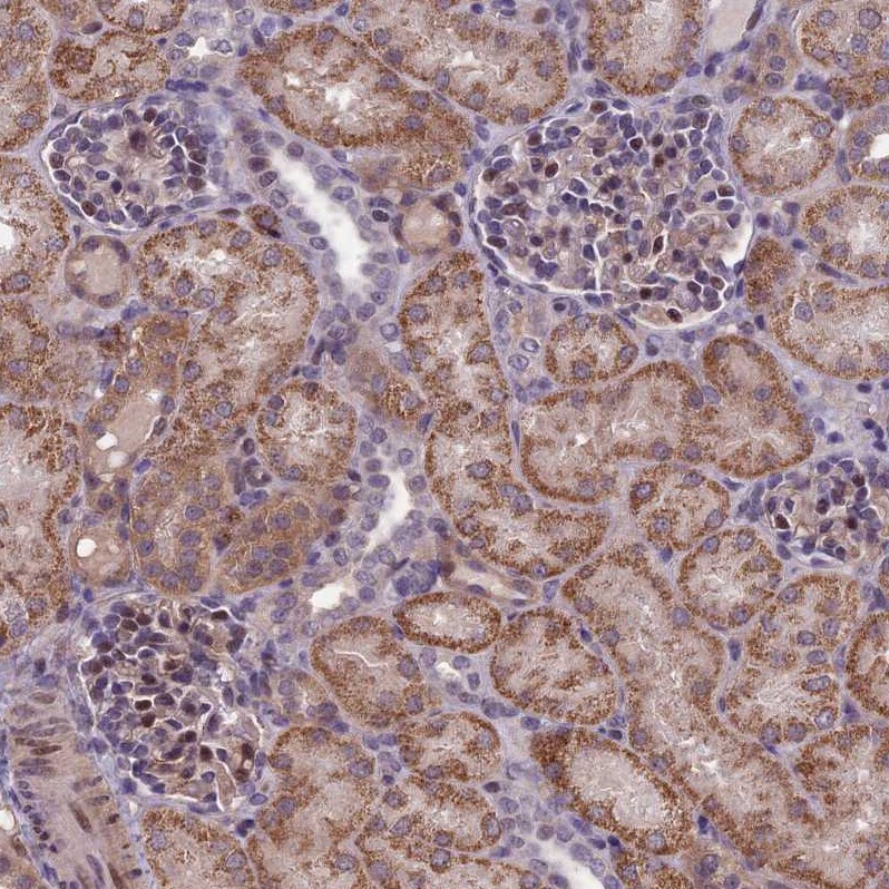 FBRS Antibody - BSA Free Immunohistochemistry-Paraffin: FBRS Antibody - BSA Free [NBP1-83917]