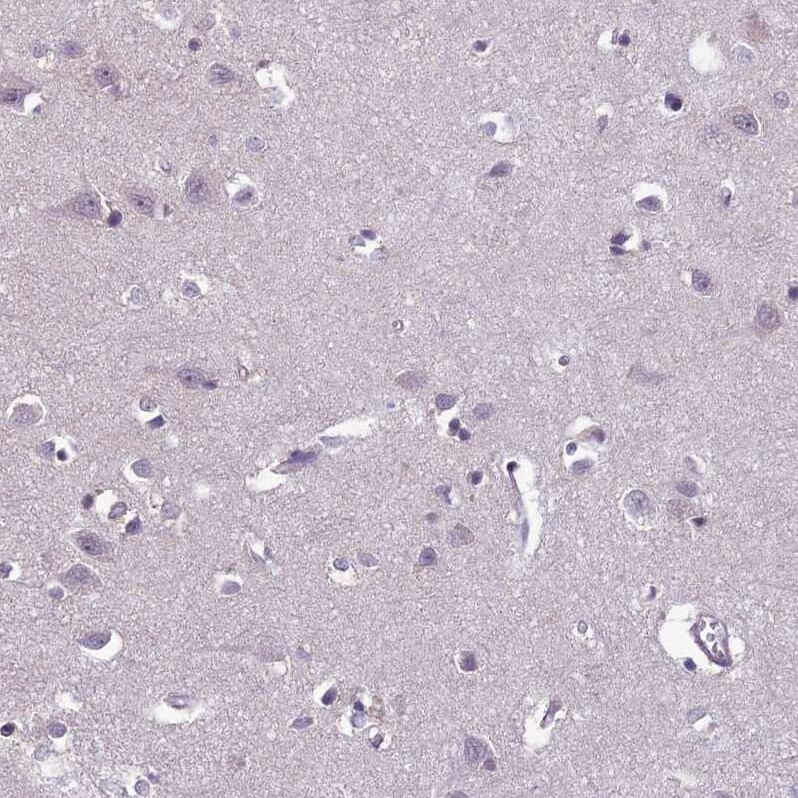 FBRS Antibody - BSA Free Immunohistochemistry-Paraffin: FBRS Antibody - BSA Free [NBP1-83917]