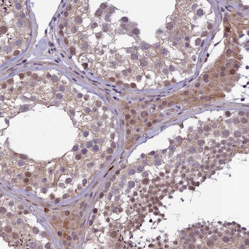 FBRS Antibody - BSA Free Immunohistochemistry-Paraffin: FBRS Antibody - BSA Free [NBP1-83917]