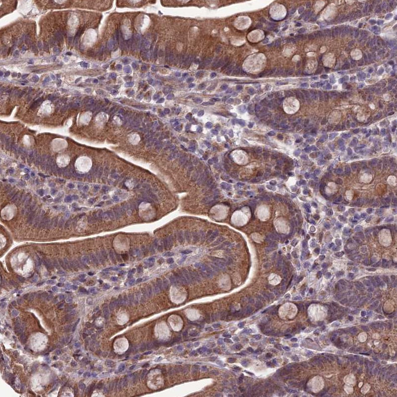 FBRS Antibody - BSA Free Immunohistochemistry-Paraffin: FBRS Antibody - BSA Free [NBP1-83917]
