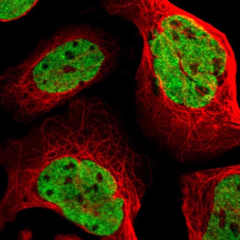 FUBP1 Antibody - BSA Free Immunocytochemistry/ Immunofluorescence: FUBP1 Antibody [NBP1-83918]