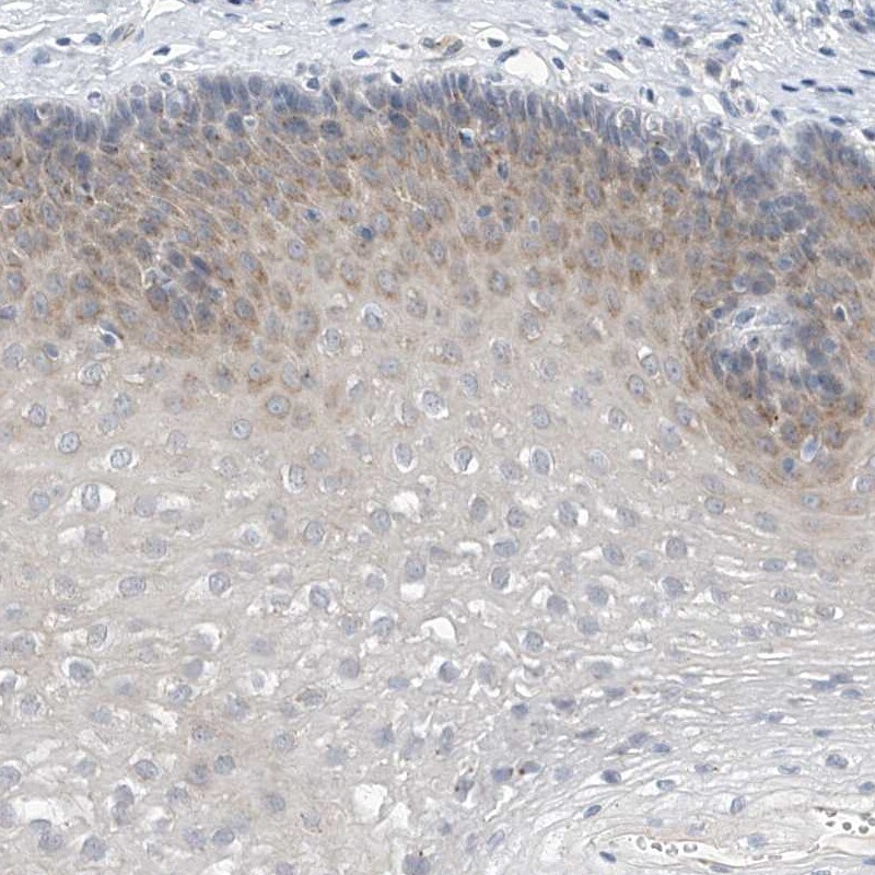 LRRC29 Antibody - BSA Free Immunohistochemistry-Paraffin: LRRC29 Antibody [NBP1-83919]