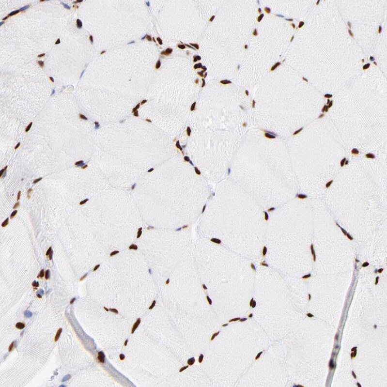 FBXO18 Antibody - BSA Free Immunohistochemistry-Paraffin: FBXO18 Antibody - BSA Free [NBP1-83921]
