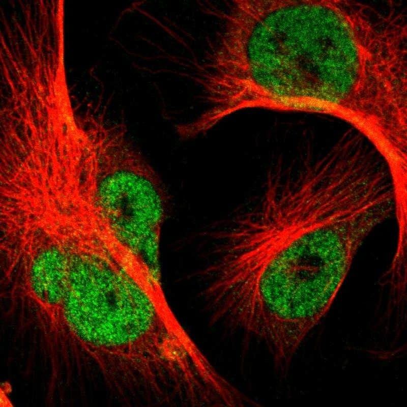 p63/TP73L Antibody Immunocytochemistry/ Immunofluorescence: p63/TP73L Antibody [NBP1-84894]