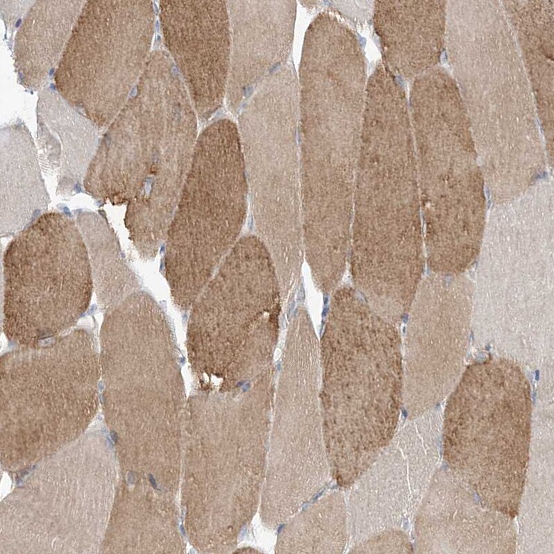 FARSB Antibody - BSA Free Immunohistochemistry-Paraffin: FARSB Antibody - BSA Free [NBP1-83923]