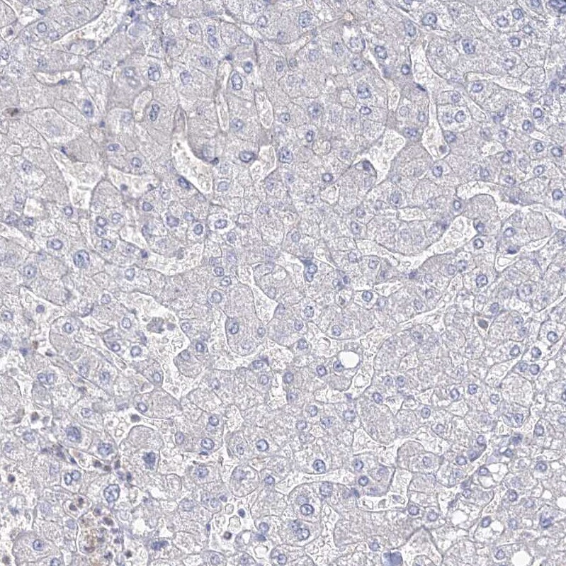 FARSB Antibody - BSA Free Immunohistochemistry-Paraffin: FARSB Antibody - BSA Free [NBP1-83923]