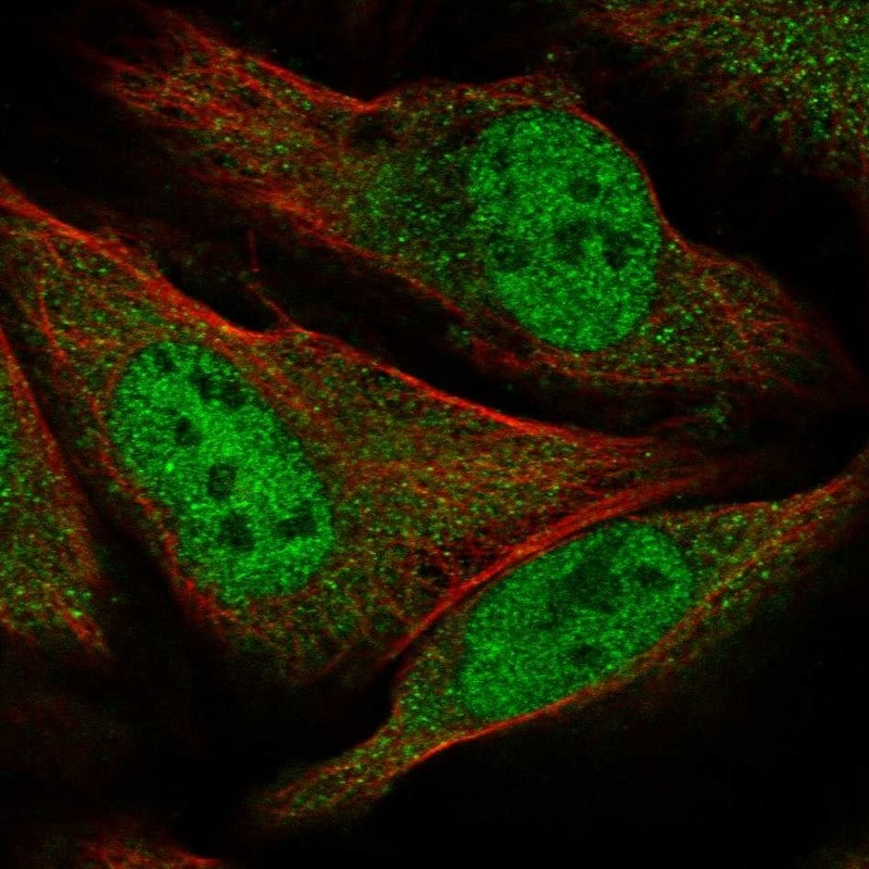 GEMIN8 Antibody - BSA Free Immunocytochemistry/ Immunofluorescence: GEMIN8 Antibody [NBP1-83925]