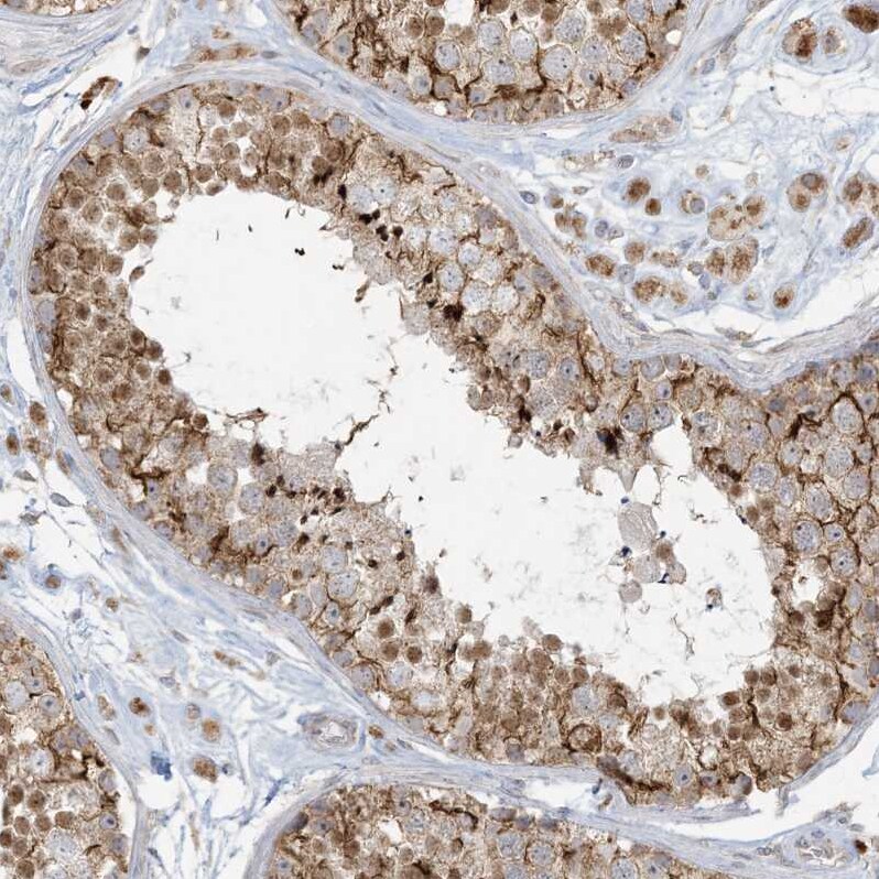 MCAT Antibody - BSA Free Immunohistochemistry-Paraffin: MCAT Antibody - BSA Free [NBP1-83936]
