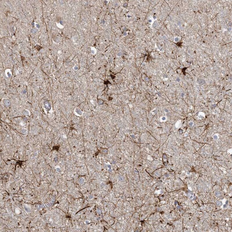 MCAT Antibody - BSA Free Immunohistochemistry-Paraffin: MCAT Antibody - BSA Free [NBP1-83936]
