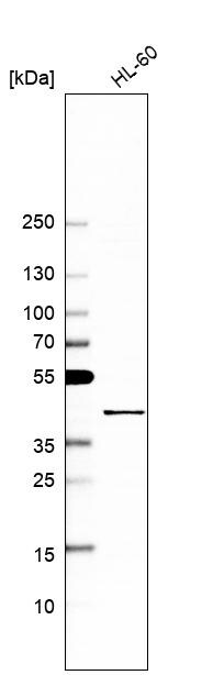 MCAT Antibody - BSA Free Western Blot: MCAT Antibody - BSA Free [NBP1-83936]
