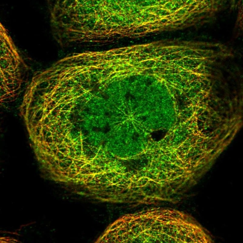 HOXC8 Antibody Immunocytochemistry/ Immunofluorescence: HOXC8 Antibody [NBP1-81719]