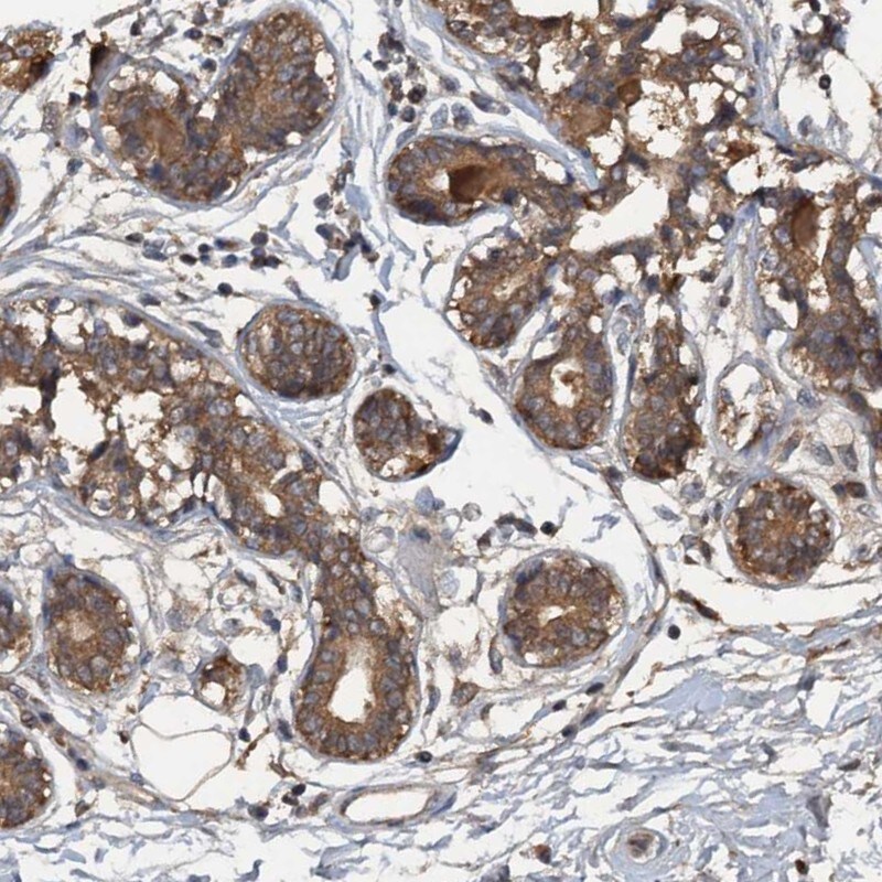 HAPLN3 Antibody - BSA Free Immunohistochemistry-Paraffin: HAPLN3 Antibody [NBP1-83945]
